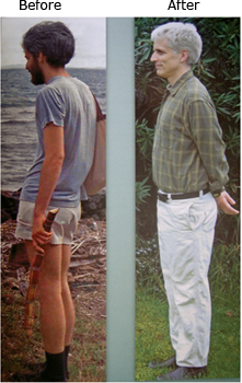 Posture_before_after
